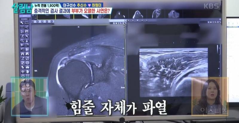 [살림남] 추신수 은퇴 전 몸상태 | 인스티즈
