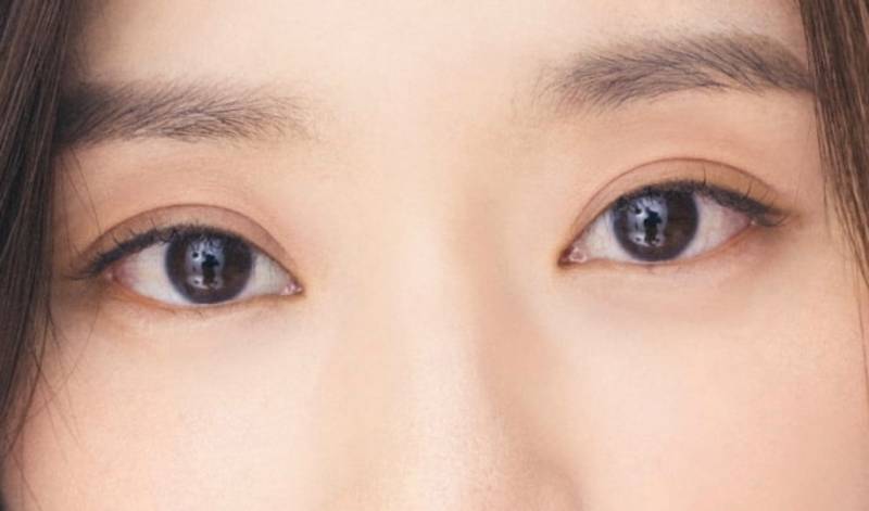 [잡담] 이 쌍커풀응 무슨 라인이야? | 인스티즈