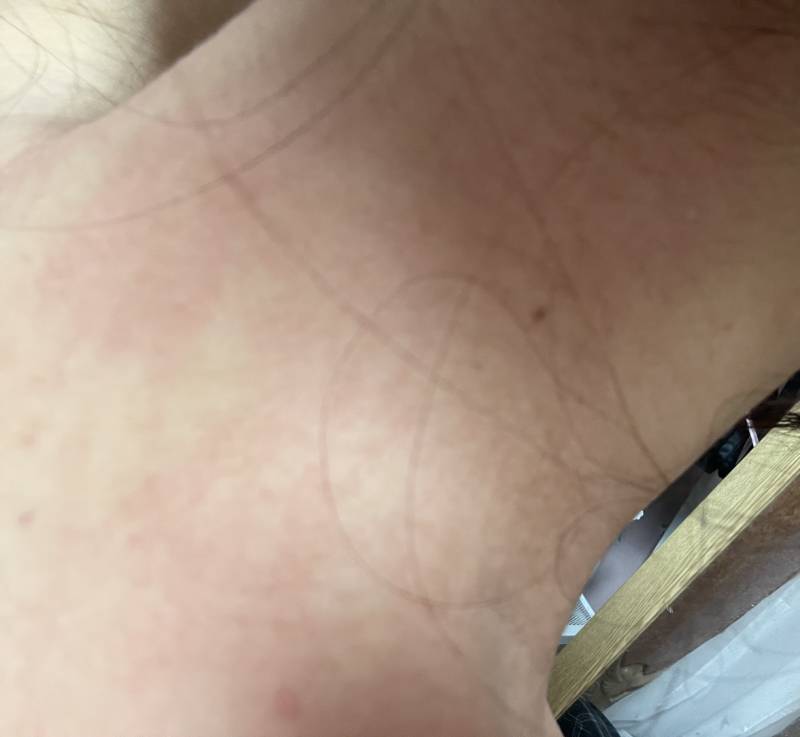 [잡담] 나 응급실 가야 하나?? 이거 왜이러지ㅠㅠㅠ | 인스티즈