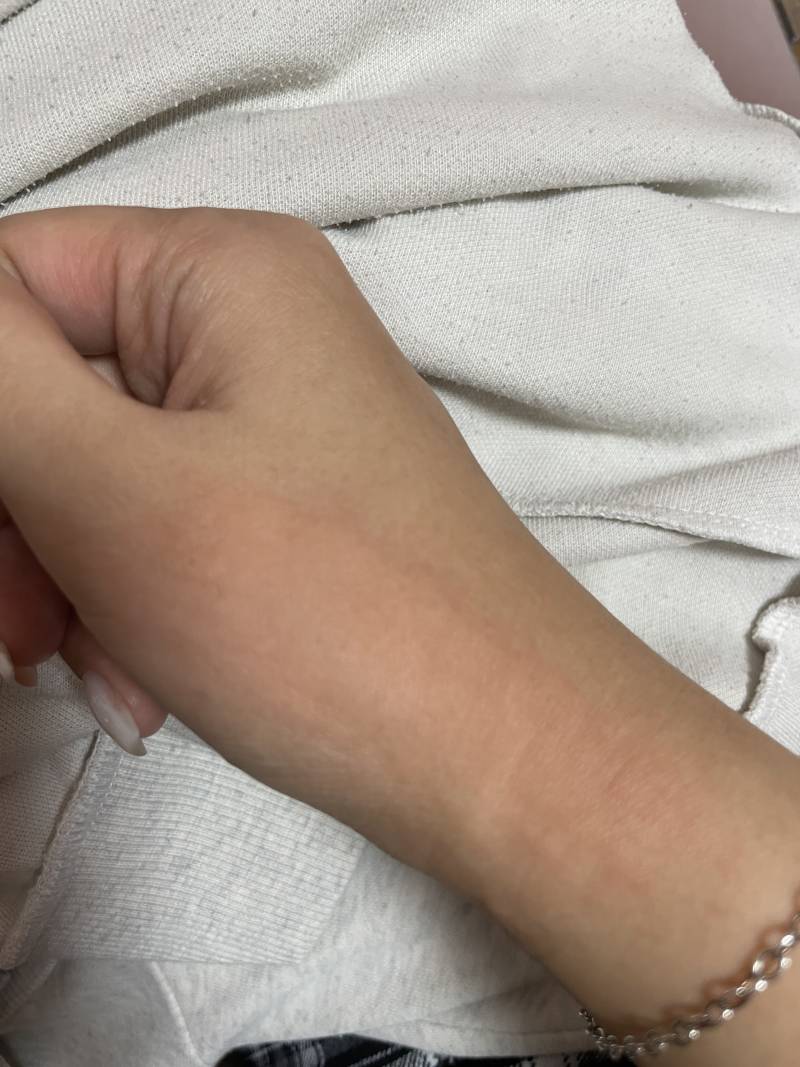 [잡담] 나 응급실 가야 하나?? 이거 왜이러지ㅠㅠㅠ | 인스티즈