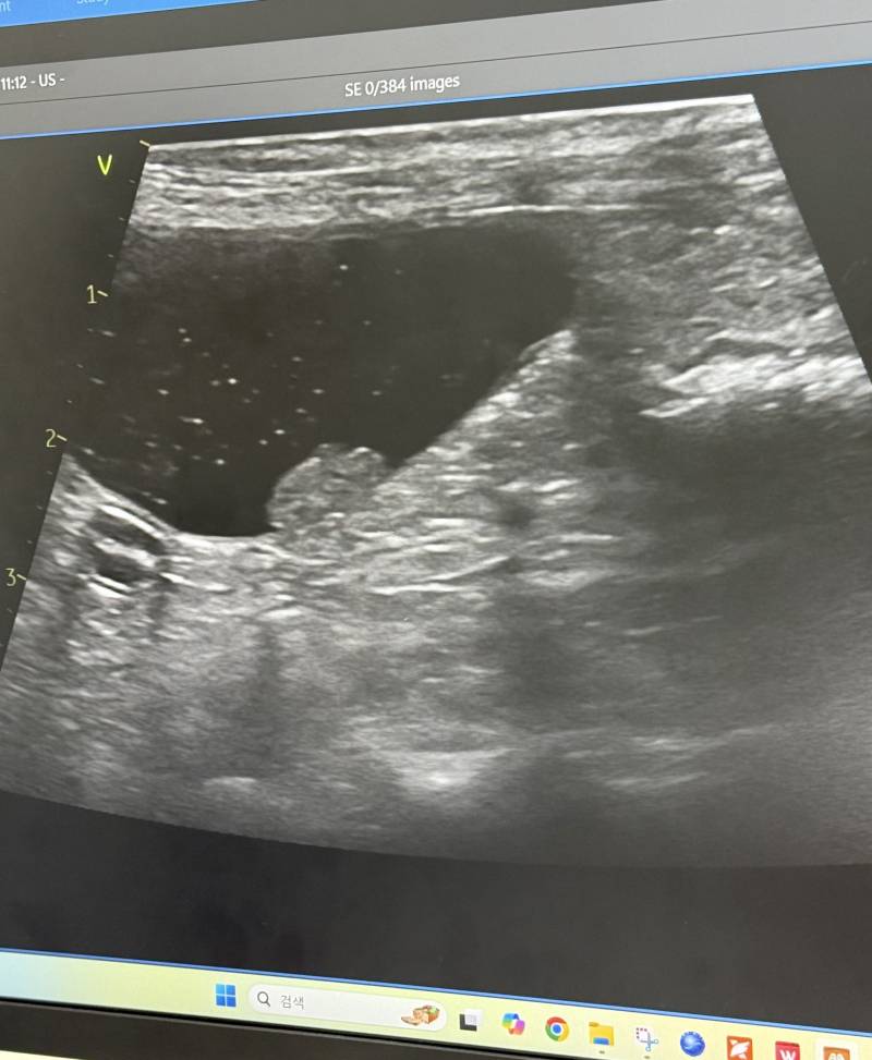 [잡담] 애들아 이거 초음파 사진보면 임신한거 같아? | 인스티즈