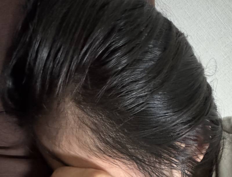 [잡담] 나 탈모 맞는거 같지? | 인스티즈
