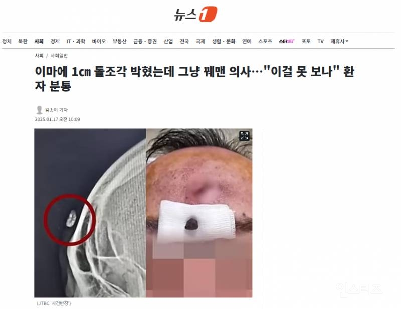 이마에 1㎝ 돌조각 박혔는데 그냥 꿰맨 의사 | 인스티즈