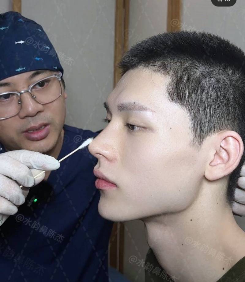 공개되고 충격적이라는 반응많았던 코 수술 사진..JPG | 인스티즈