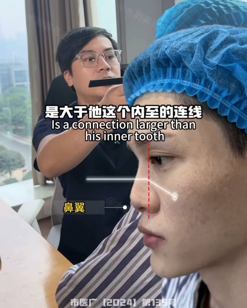 공개되고 충격적이라는 반응많았던 코 수술 사진..JPG | 인스티즈