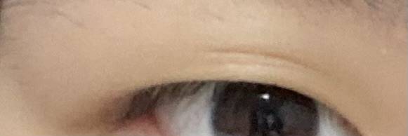 [잡담] 이거 나이들어도 쌍커풀 절대 안생기겠지..?? | 인스티즈