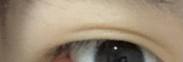 [잡담] 이거 나이들어도 쌍커풀 절대 안생기겠지..?? | 인스티즈