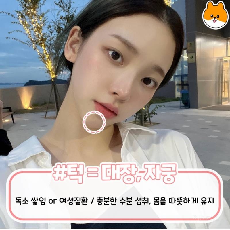 부위별로 나는 여드름 총정리.jpg | 인스티즈