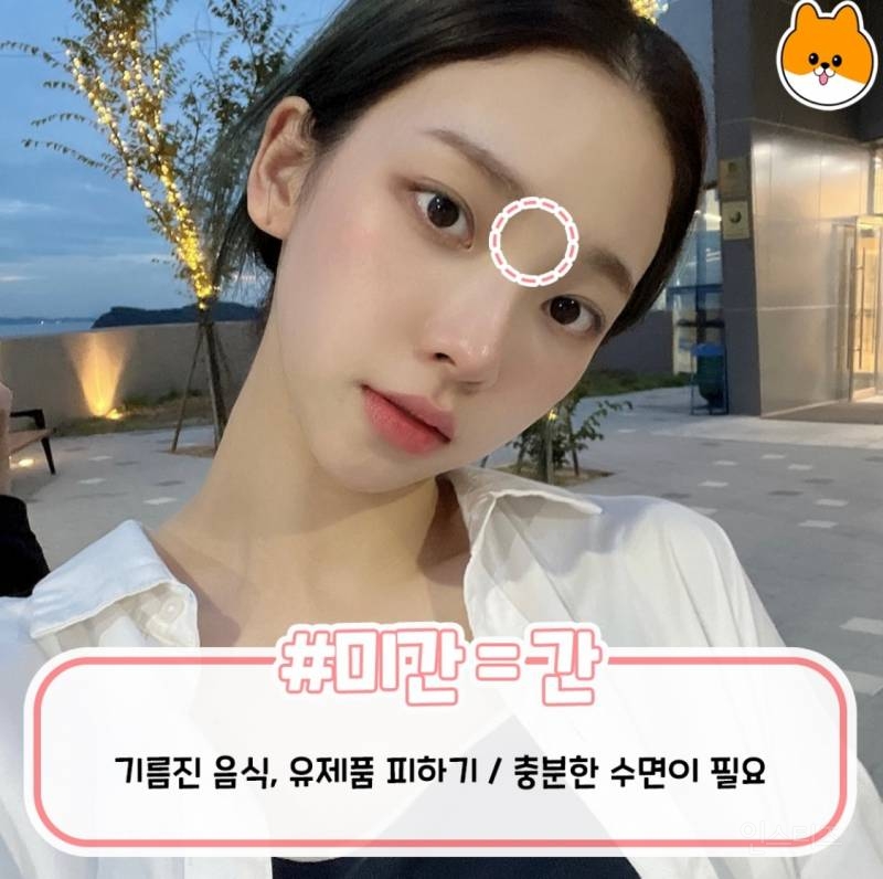 부위별로 나는 여드름 총정리.jpg | 인스티즈