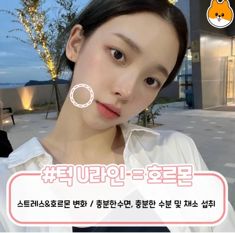 부위별로 나는 여드름 총정리.jpg | 인스티즈