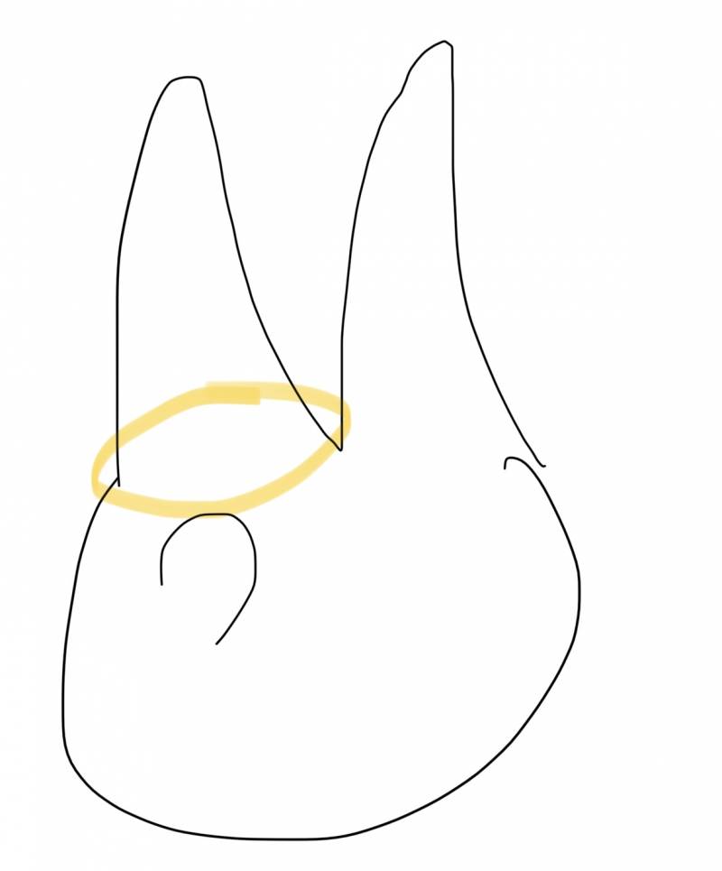 [잡담] 손가락 이렇게 생긴건 살빼면 돼? ㅠㅠ | 인스티즈