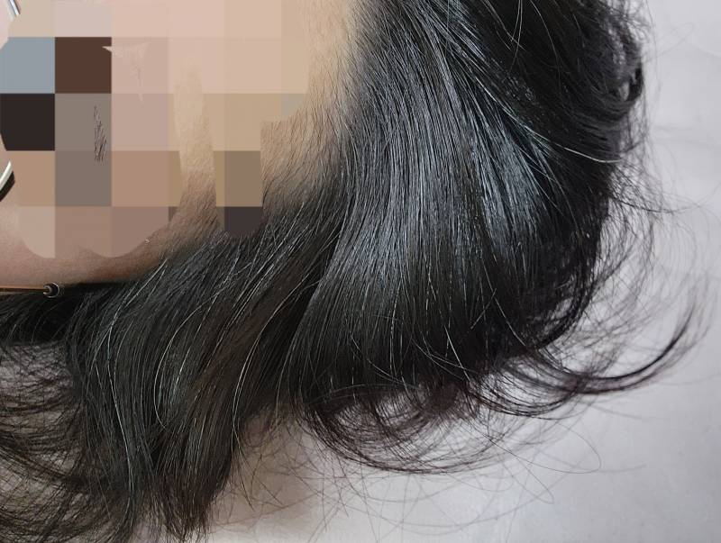 [잡담] 25샬인데 흰머리 이만큼나고있음 | 인스티즈