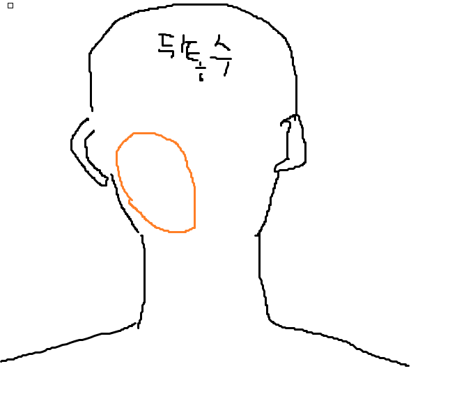 [잡담] 두피의 일정 부분만 머리냄새가 심한데 왜그러지 | 인스티즈