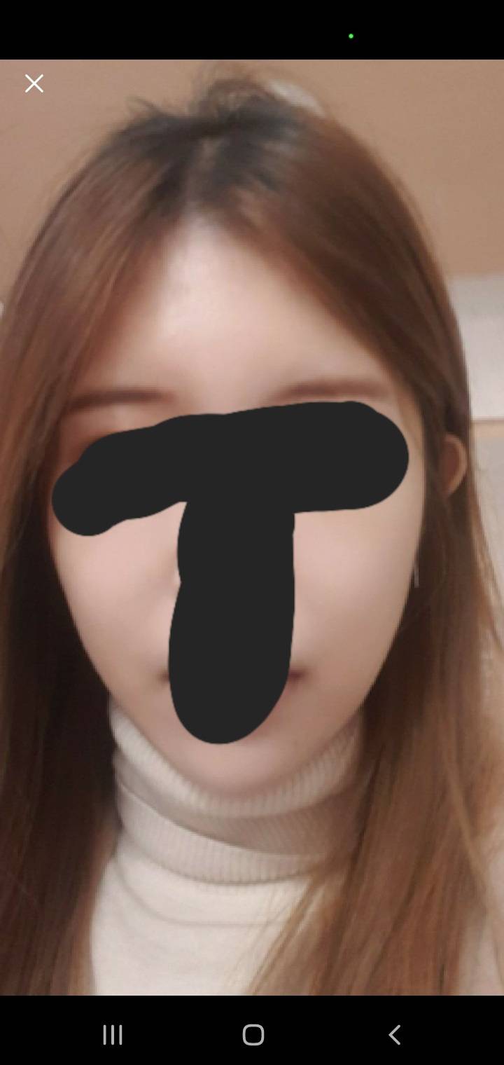 [잡담] 10키로 차이인데 얼굴살 차이 많이난다 | 인스티즈