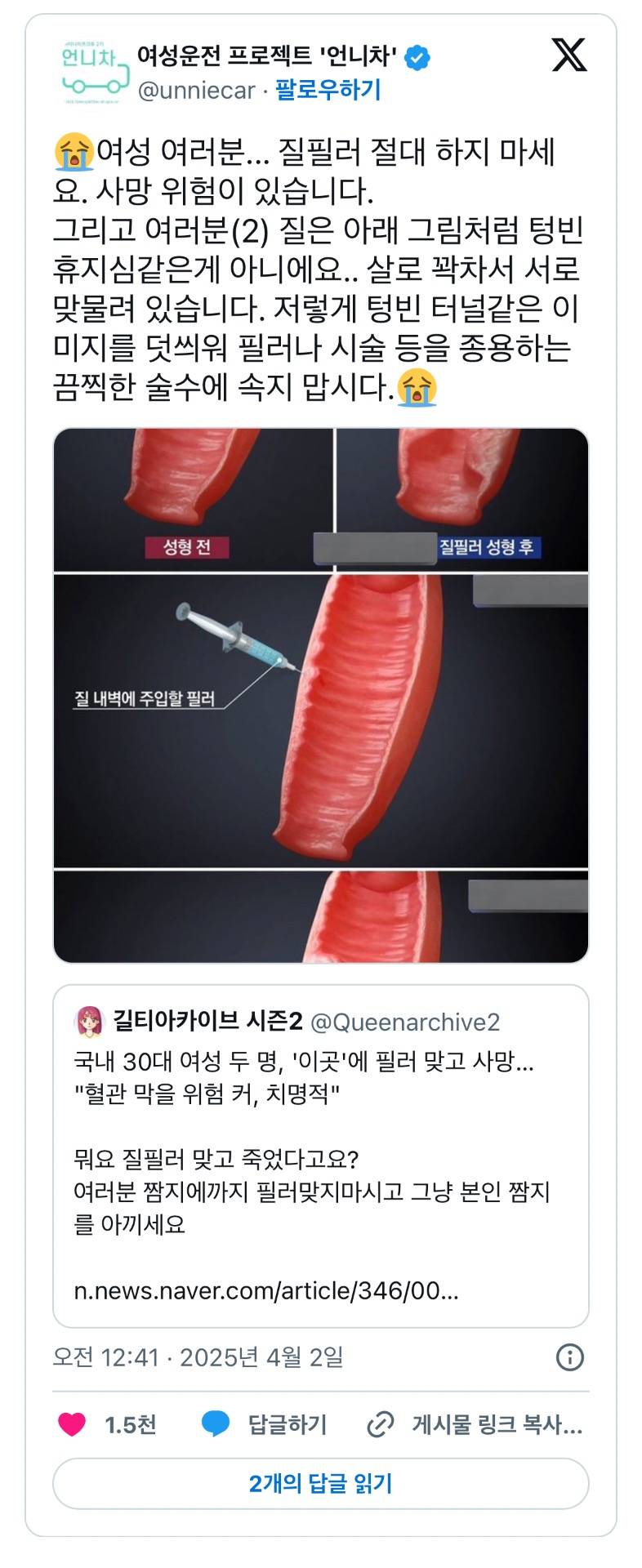 경악스럽다는 질 필러 시술 후기.JPG | 인스티즈