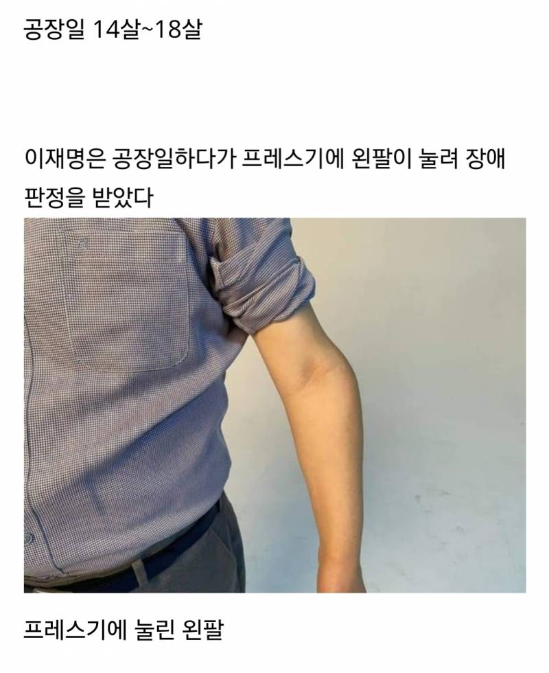  처음 알면 개놀란다는 이재명 몸 상태......jpg2