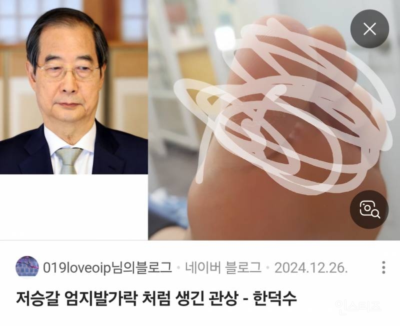 한덕수 엄지발가락 싱크율 99.999%ㅋㅋㅋㅋㅋㅋㅋㅋㅋㅋ | 인스티즈