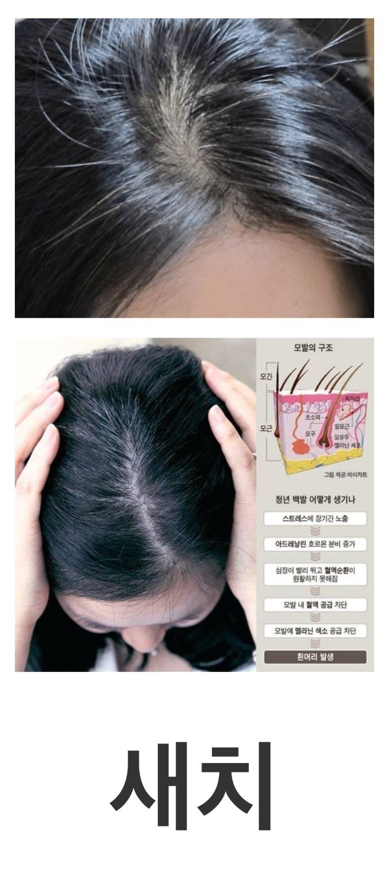 20대들한테도 흔하게 생긴다는 것..jpg | 인스티즈