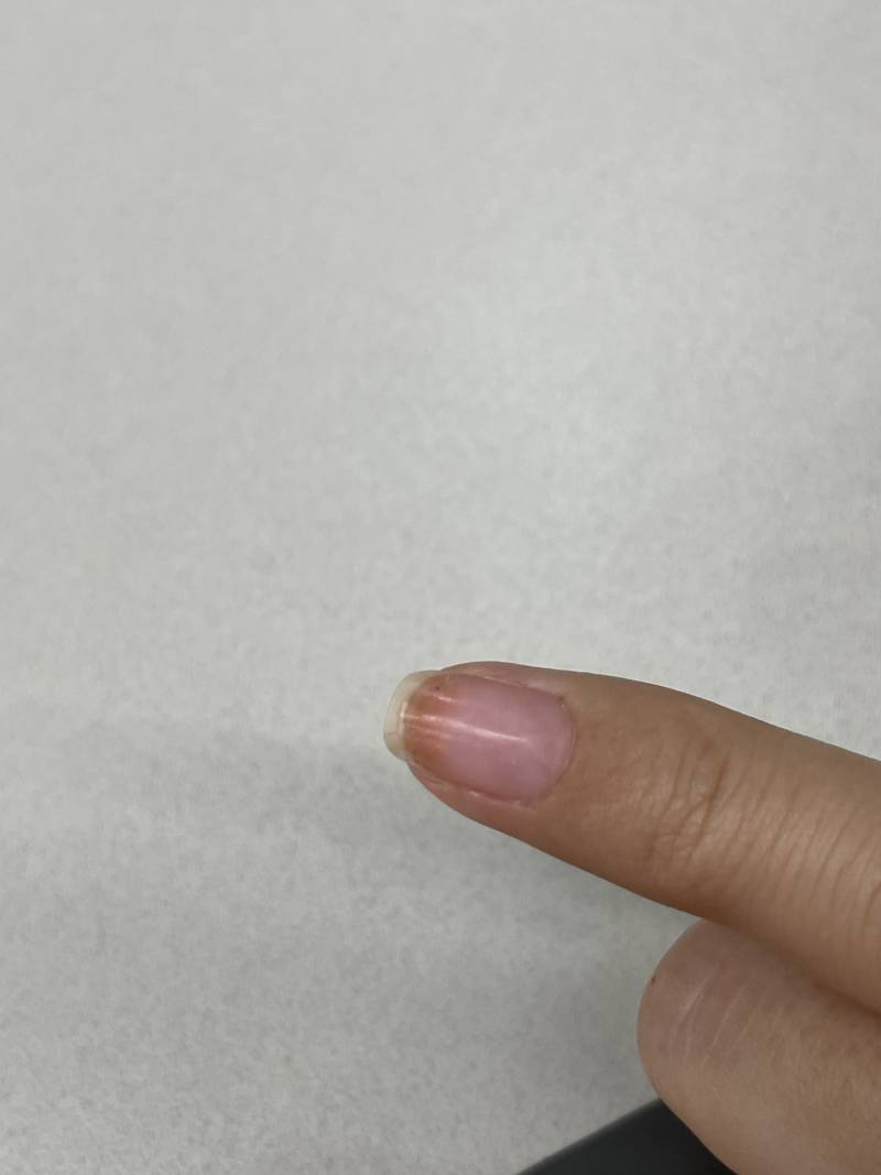 [잡담] 네일 너무 오래해서 손톱 착색 된거 처음 봐..ㅋㅋㅋㅋ | 인스티즈