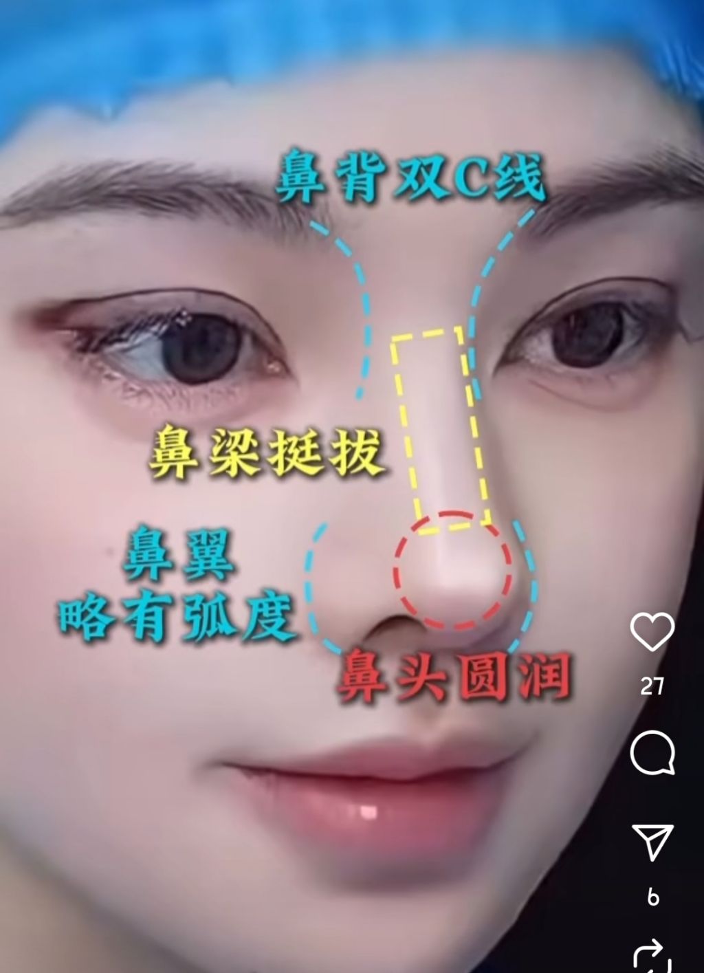 [정보/소식] 점점 기괴해지는 중국의 성형 근황 (허리) | 인스티즈
