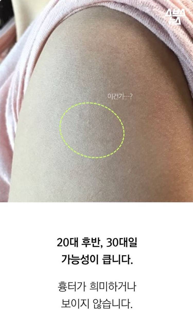 현재 답변 갈리는 불주사 자국.JPG | 인스티즈