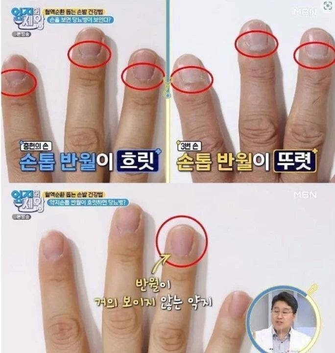 한의사 피셜 당뇨 진단법. jpg