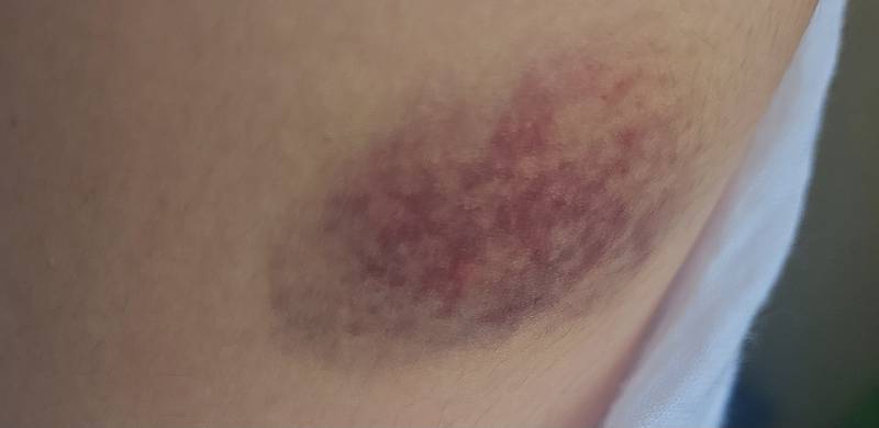 [잡담] ㅜ ㅜ나 5월에 결혼식인데 | 인스티즈