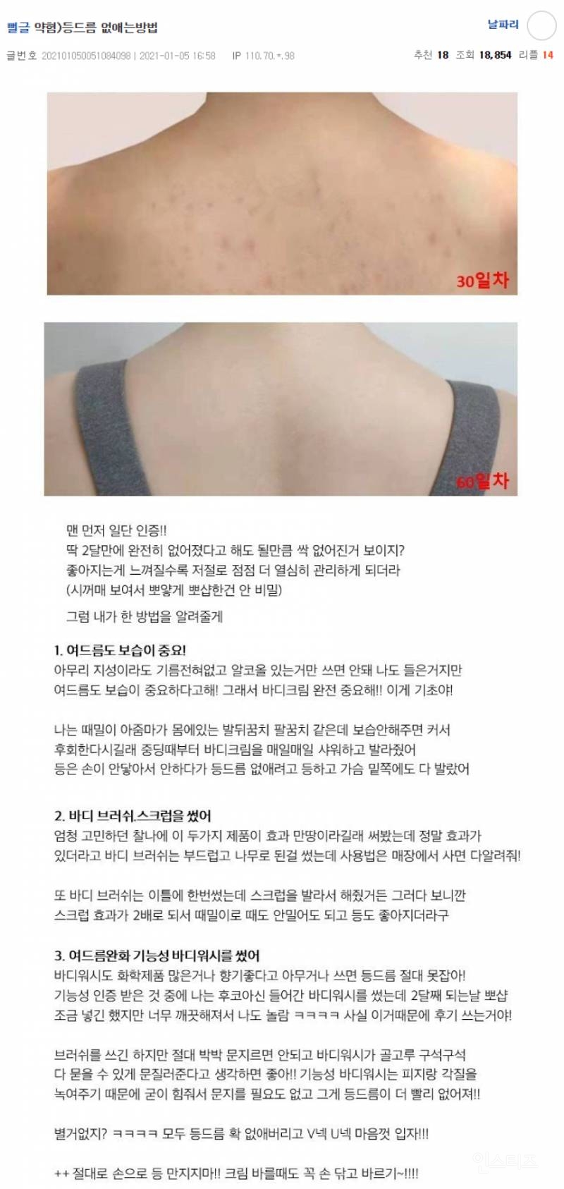  (혐) 등드름 없애는방법