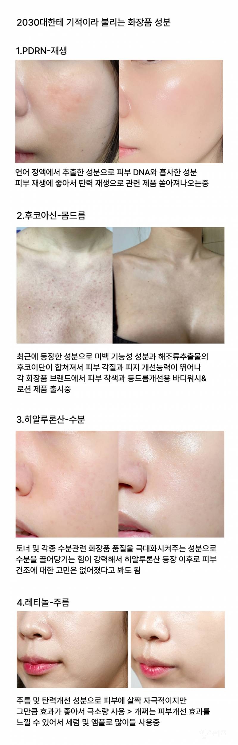  2030에게 기적이라 불리는 성분들