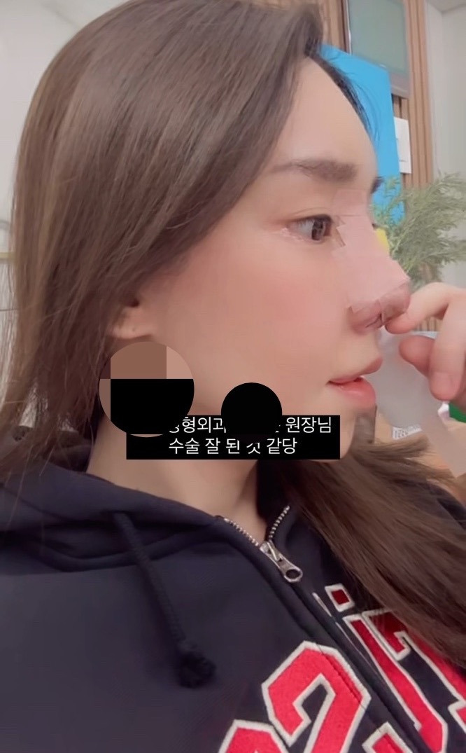  최근 15번째 코 수술을 마친 트랜스젠더 꽃자.JPG7