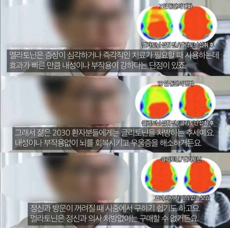 유독 한국사람한테 많이 보인다는 증상.jpg | 인스티즈