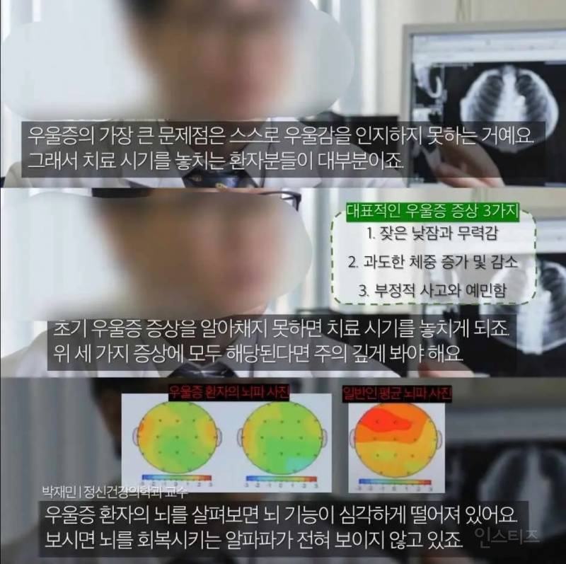 유독 한국사람한테 많이 보인다는 증상.jpg | 인스티즈