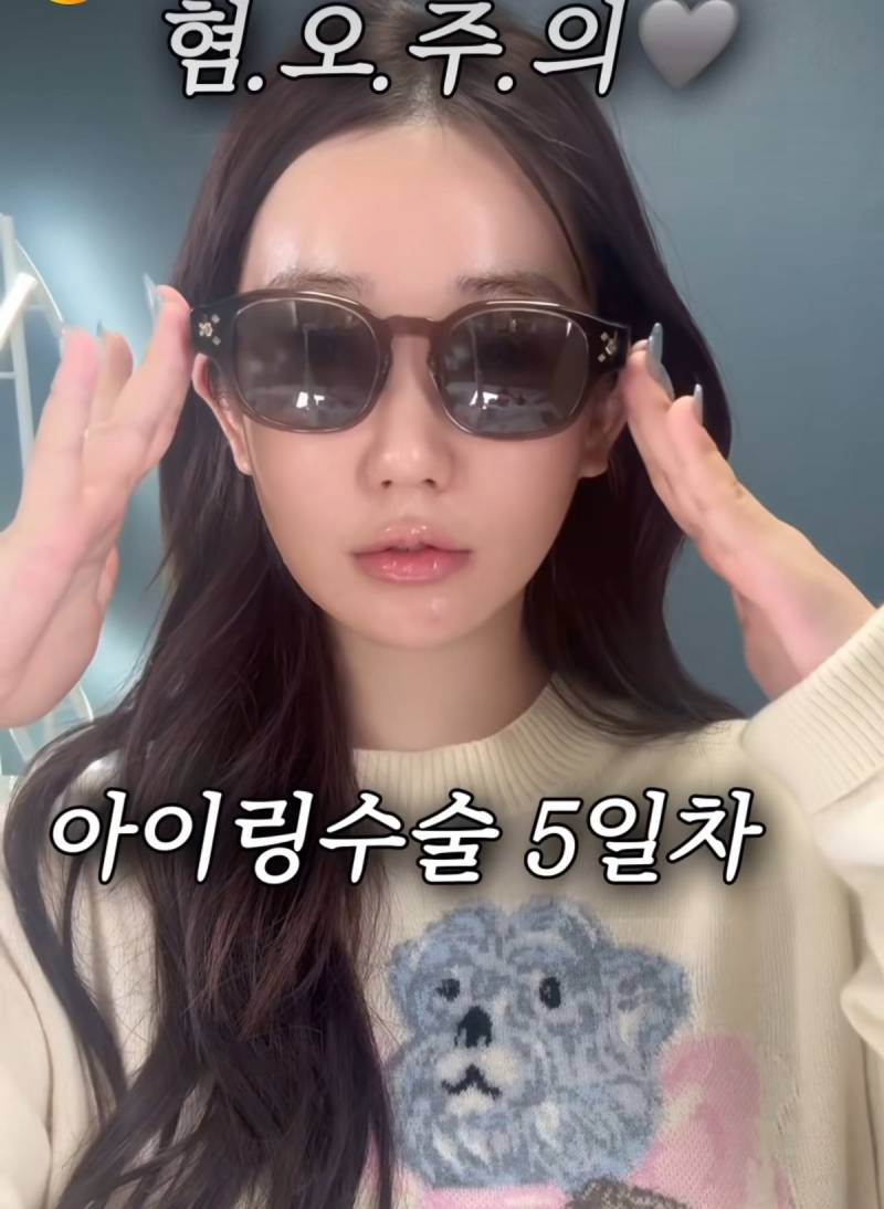 현재 여론 살벌한 눈동자 성형수술.JPG (충격주의) | 인스티즈