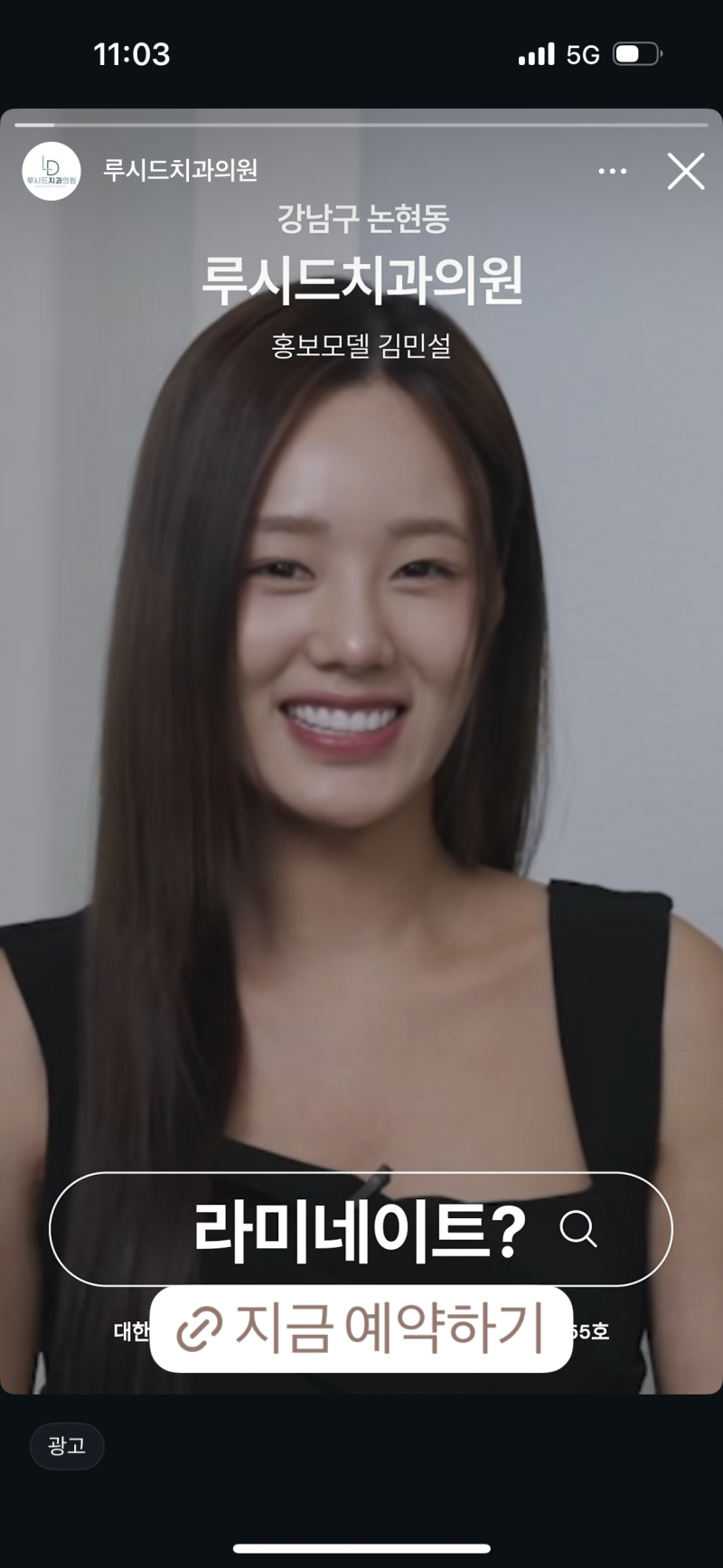 [잡담] 인플루언서들 라미네이트 위험한데 | 인스티즈