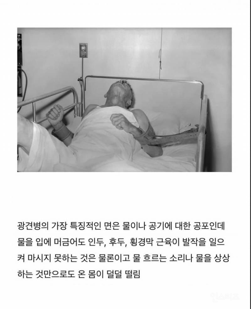 치사율 99% 이상이라는 발병후 죽는다고 생각하면 된다는 무서운 바이러스 .jpg | 인스티즈