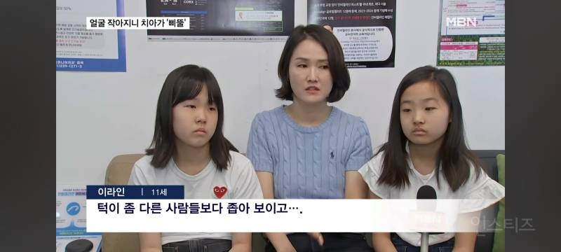 얼굴이 작아져서 치아가 기형으로 나고있다는 요즘 애들.jpg | 인스티즈