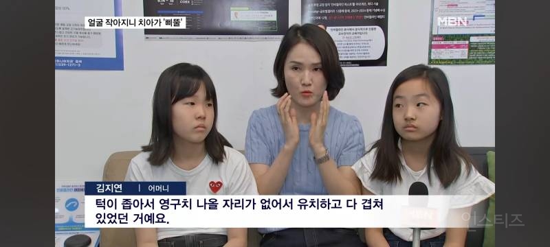얼굴이 작아져서 치아가 기형으로 나고있다는 요즘 애들.jpg | 인스티즈