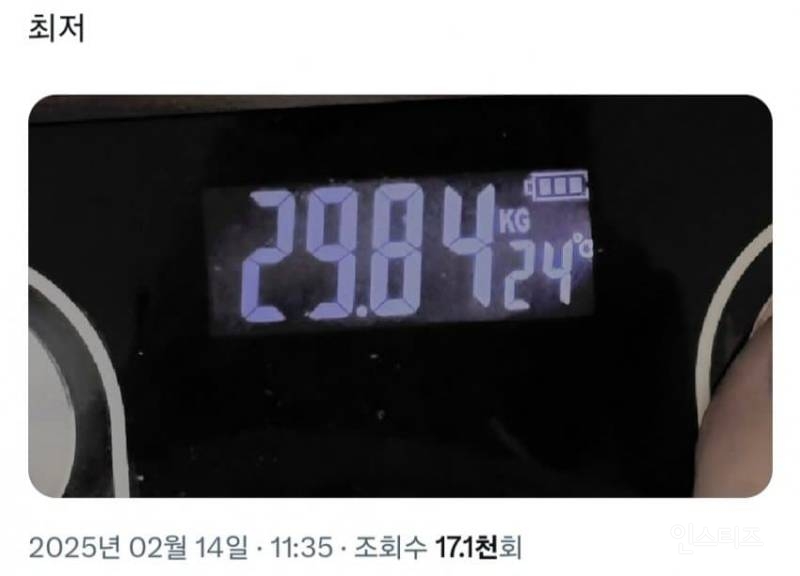  체중 29kg 이라는 거식증 20의 몸상태.jpg