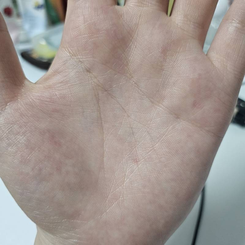 [잡담] 20대중반인데 노화 미쳤나.. | 인스티즈