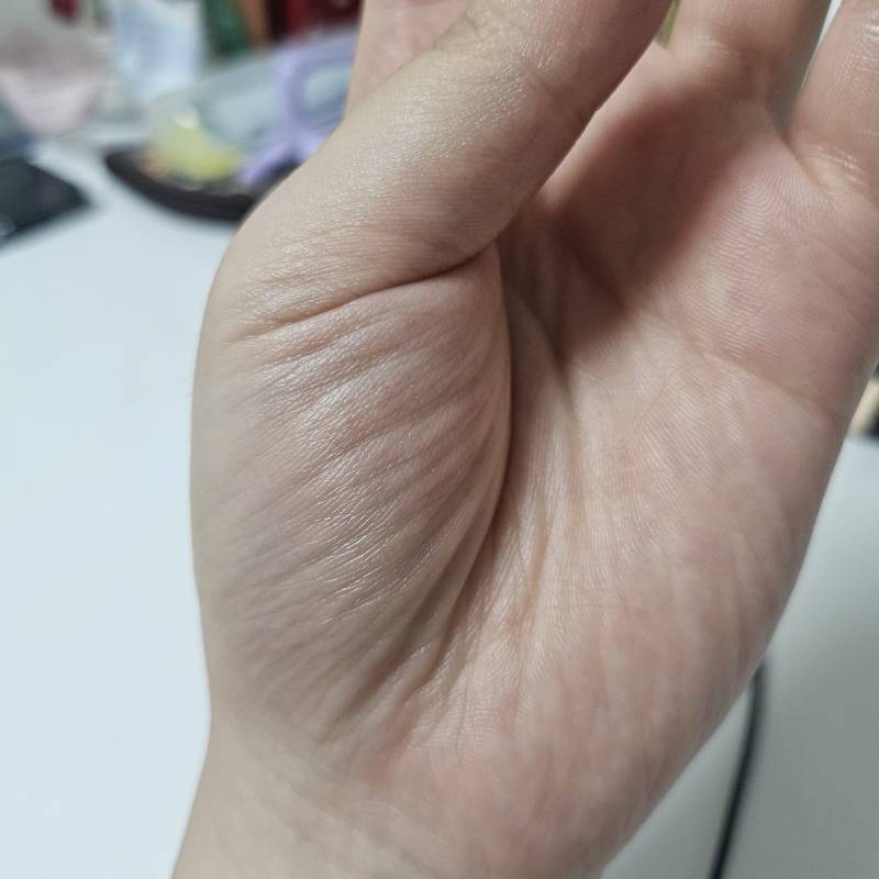 [잡담] 20대중반인데 노화 미쳤나.. | 인스티즈