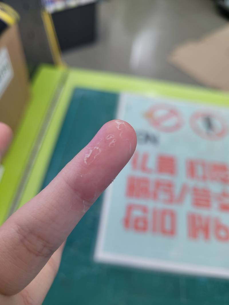 [잡담] 손 이렇게 되는 거 왜 그런 거야...?? | 인스티즈