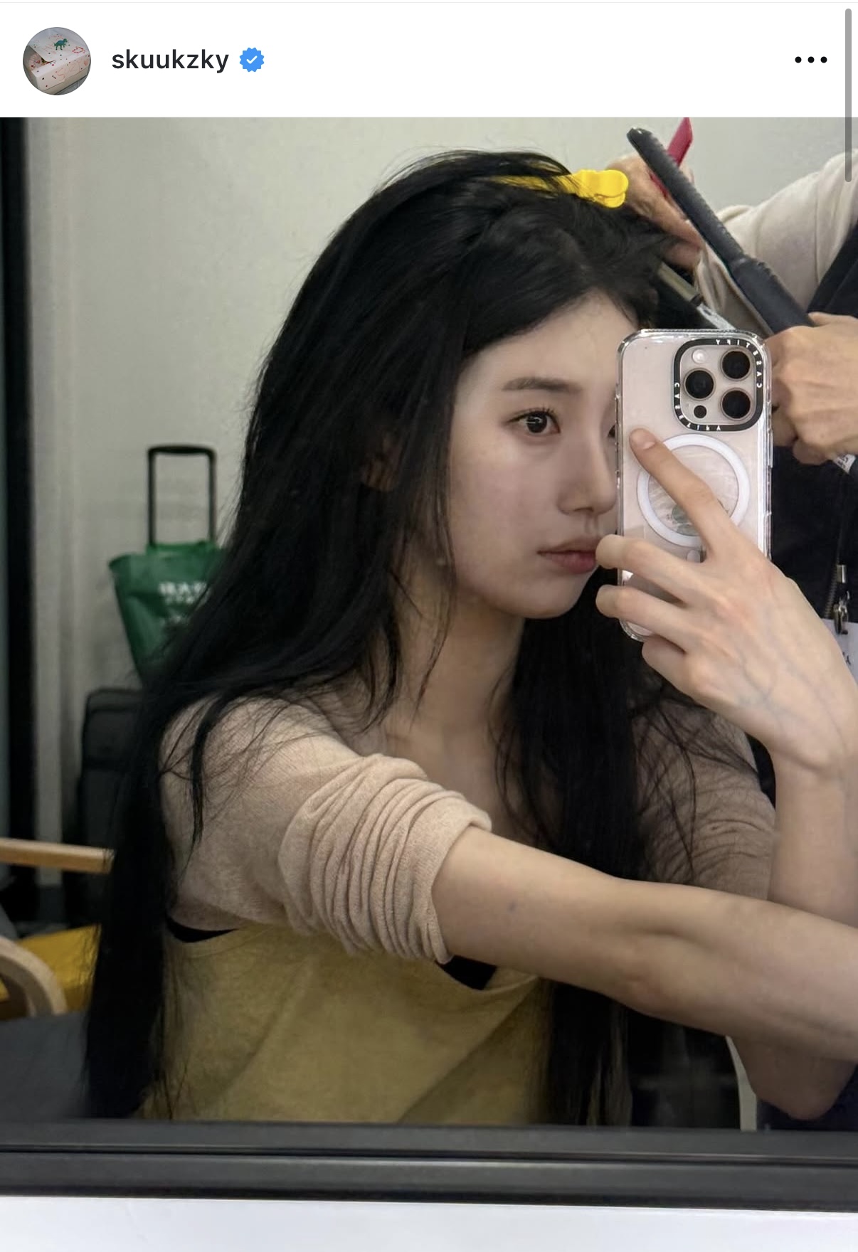 [잡담] 수지 미띤 얼굴근황 | 인스티즈