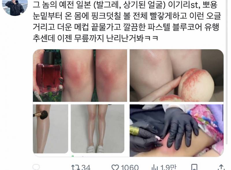 현재 댓글창 험해지고있는 무릎 향수.JPG | 인스티즈
