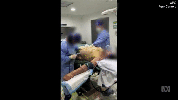 현재 개끔찍하다는 지방흡입 실제 시술 장면 (주의) | 인스티즈