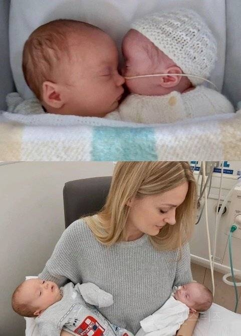 매우 희귀하다는 임신 유형 .jpg | 인스티즈