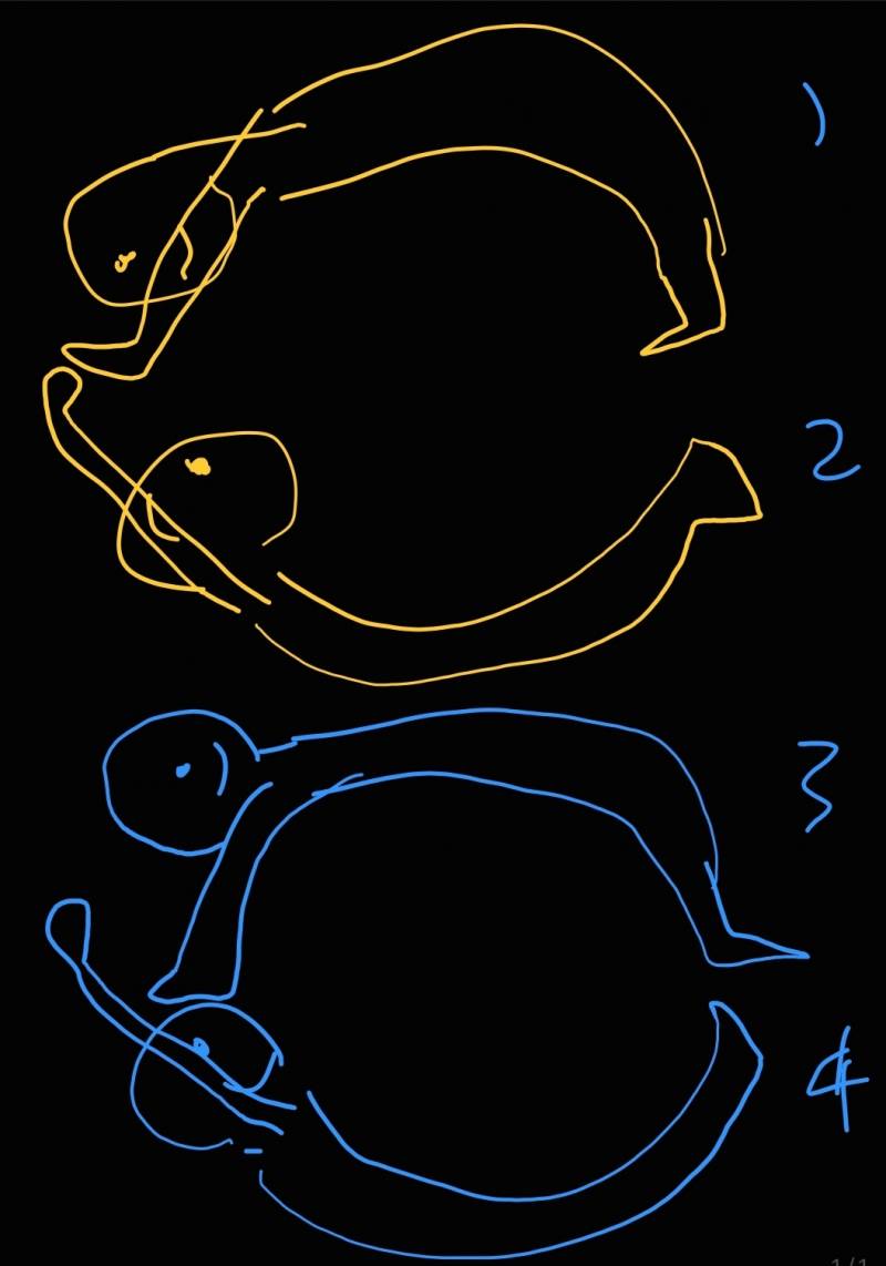 19 허리가 활처럼 휜다는 게 | 인스티즈