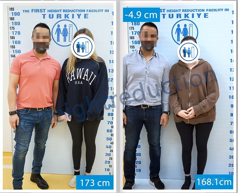 오싹오싹한 키 큰 여자들이 하는 키축소수술 | 인스티즈