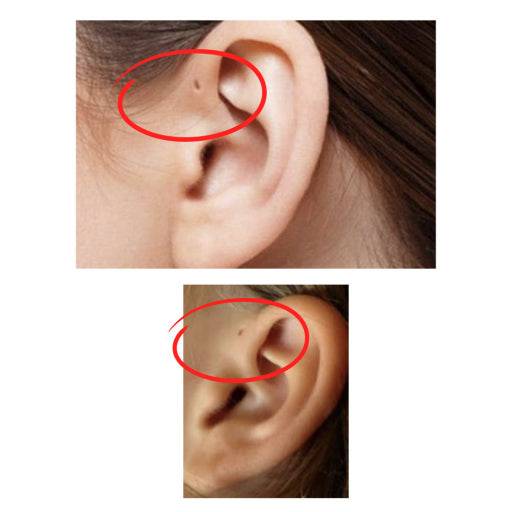 [잡담] 귀에 구멍 나있는 거 너무 스트레스임 | 인스티즈