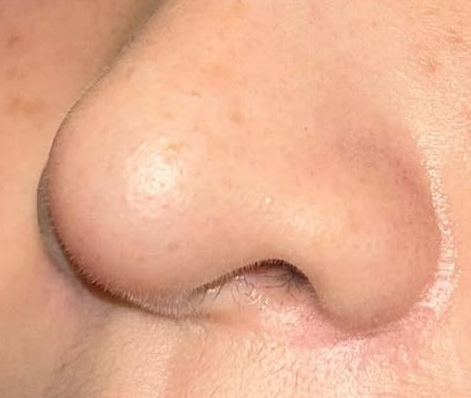 [마플] 김민하 코털 | 인스티즈