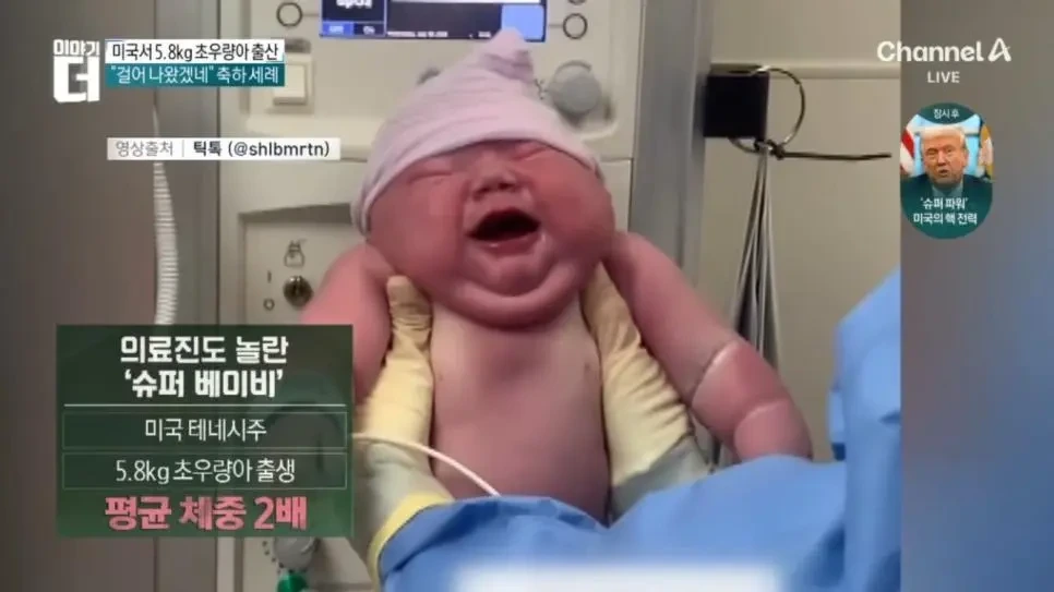 미국 5.8kg 슈퍼 베이비 출산 | 인스티즈